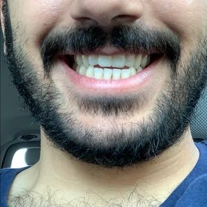 Meet your Posher, Moh